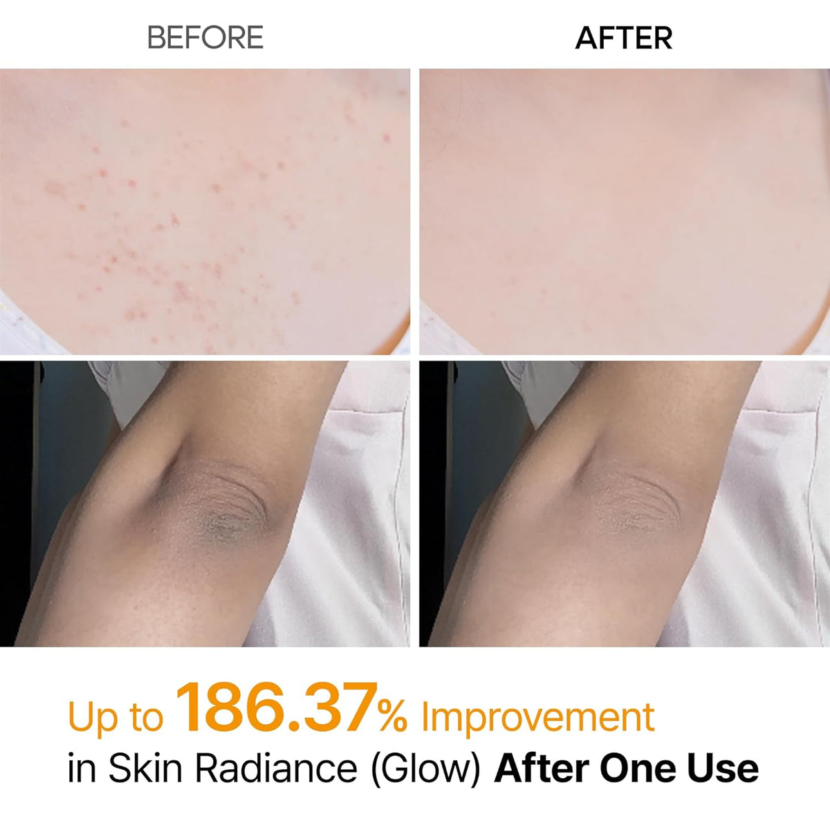 Peel Shot Kojic Acid Turmeric Body Exfoliator Spray 6.76 Fl.Oz - AHA PHA Niacinamide Body Scrub for KP Bumps, Dark Spots, Uneven Skin Tone, Dead Skin, Korean Skin Care