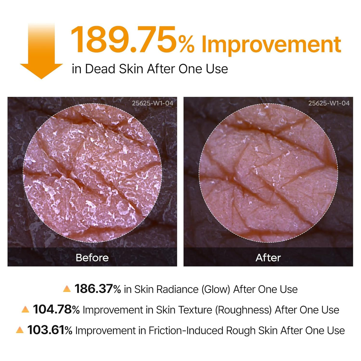 Peel Shot Kojic Acid Turmeric Body Exfoliator Spray 6.76 Fl.Oz - AHA PHA Niacinamide Body Scrub for KP Bumps, Dark Spots, Uneven Skin Tone, Dead Skin, Korean Skin Care